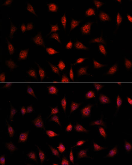 PSMB1 Antibody