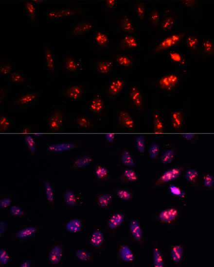 PSMB1 Antibody