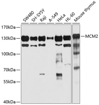 MCM2 Antibody