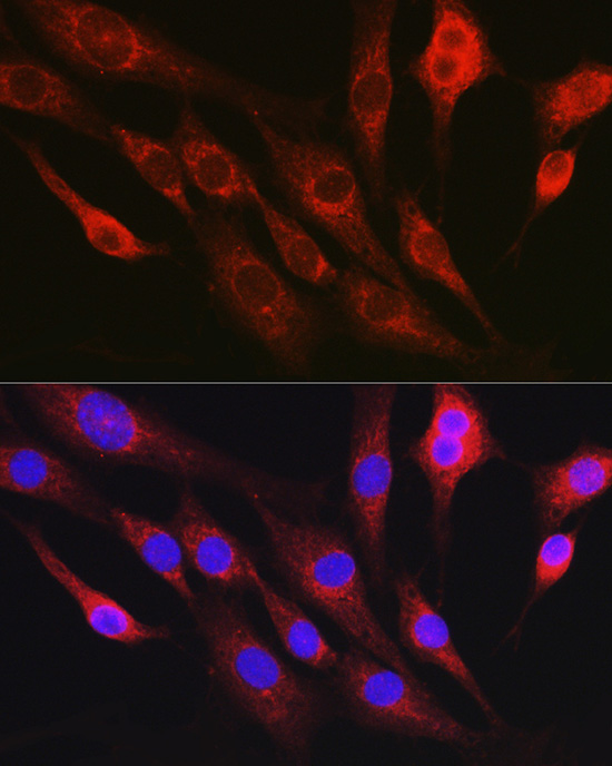 RHOC Antibody