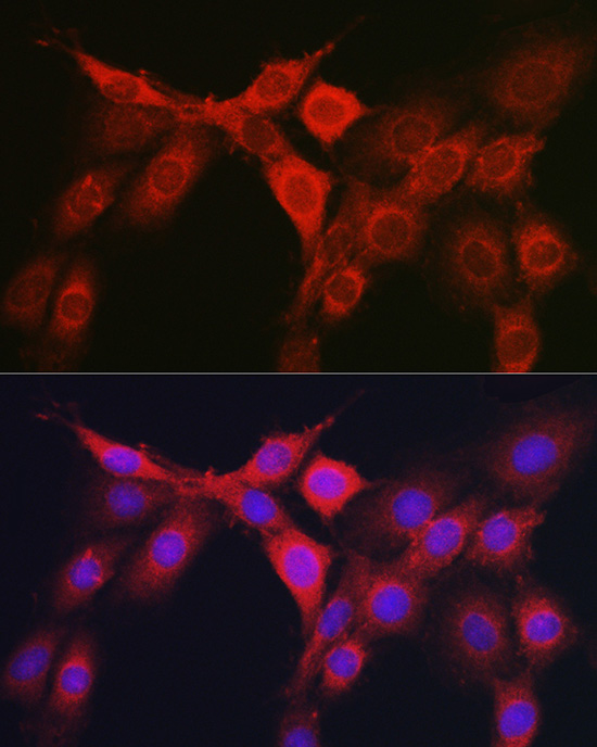 RHOC Antibody