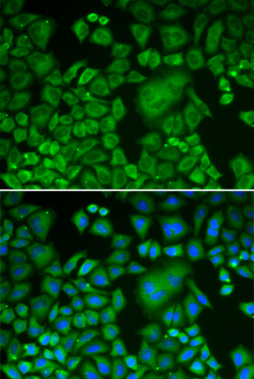 ACTR3 Antibody