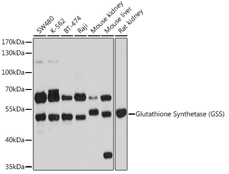 GSS Antibody