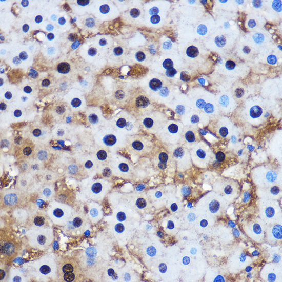 PPP1CB Antibody