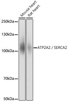 ATP2A2 Antibody