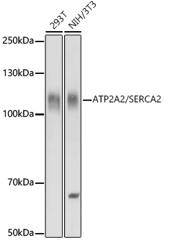 ATP2A2 Antibody