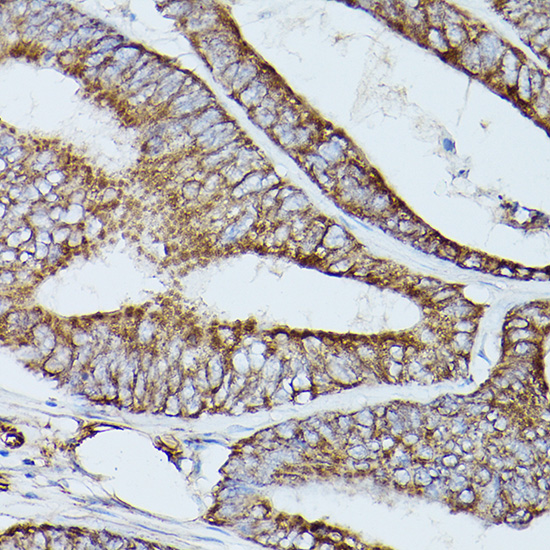 ATP2A2 Antibody