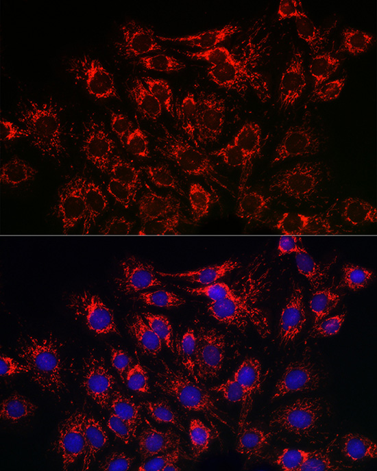 ATP2A2 Antibody