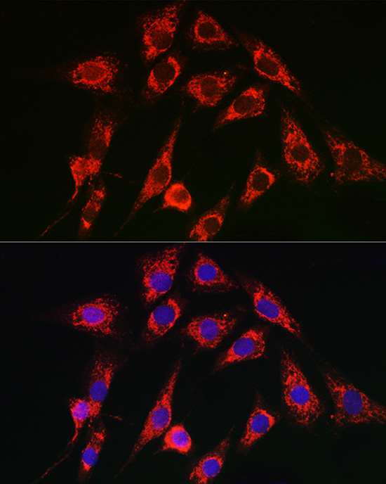 ATP2A2 Antibody