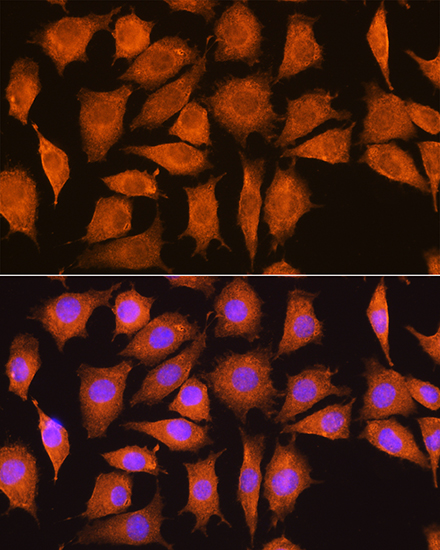 NCSTN Antibody