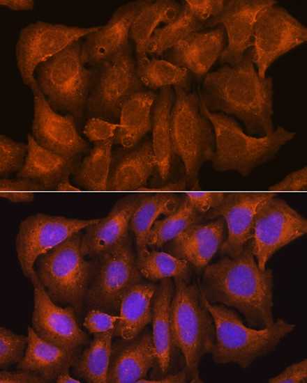 NCSTN Antibody