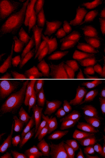 BAG1 Antibody