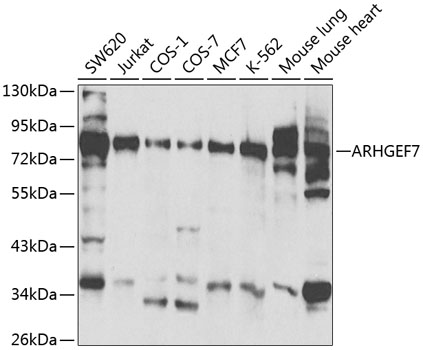 ARHGEF7 Antibody