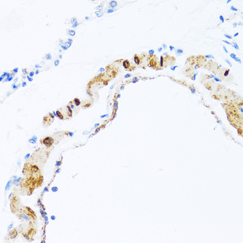 PHPT1 Antibody