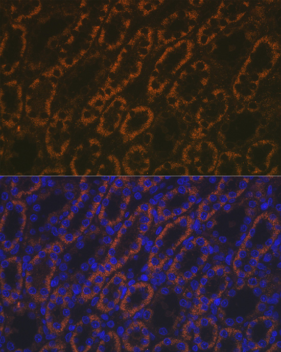 AMACR Antibody