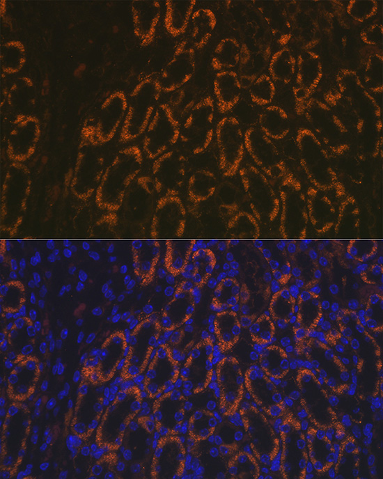 AMACR Antibody