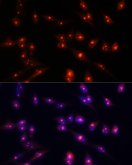 FBL Antibody