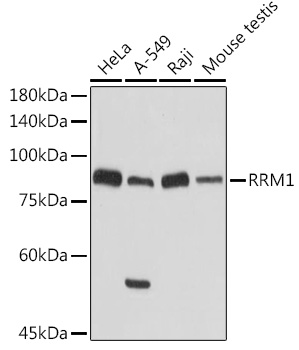 RRM1 Antibody