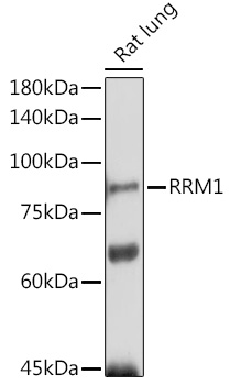 RRM1 Antibody