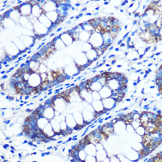 RRM1 Antibody