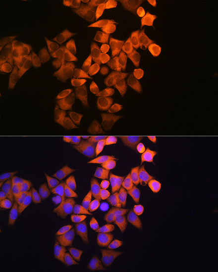 RRM1 Antibody