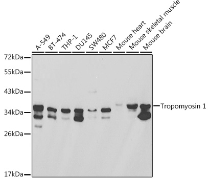 TPM1 Antibody