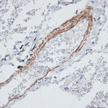 TPM1 Antibody