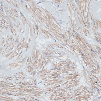 TPM1 Antibody