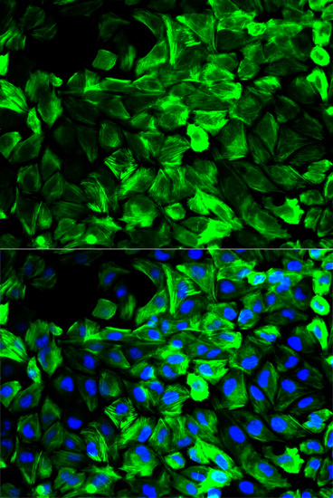 TPM1 Antibody