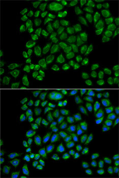 GRIA3 Antibody