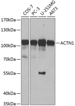 ACTN1 Antibody