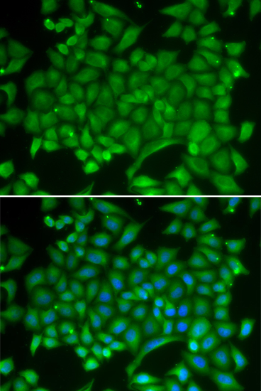 RAB11A Antibody