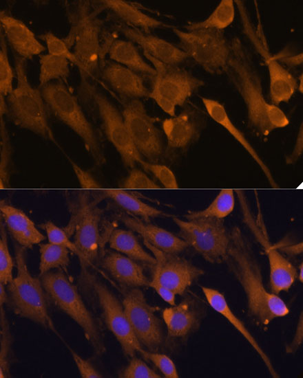 STUB1 Antibody