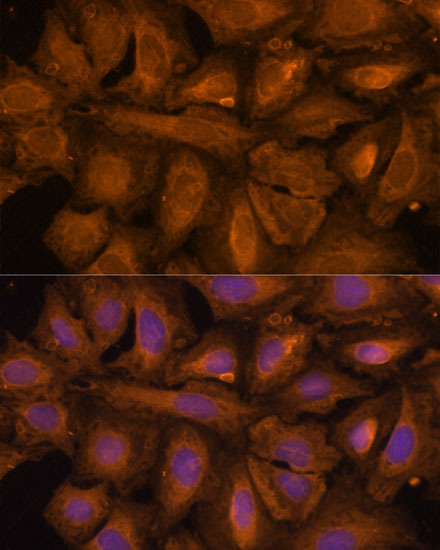 STUB1 Antibody