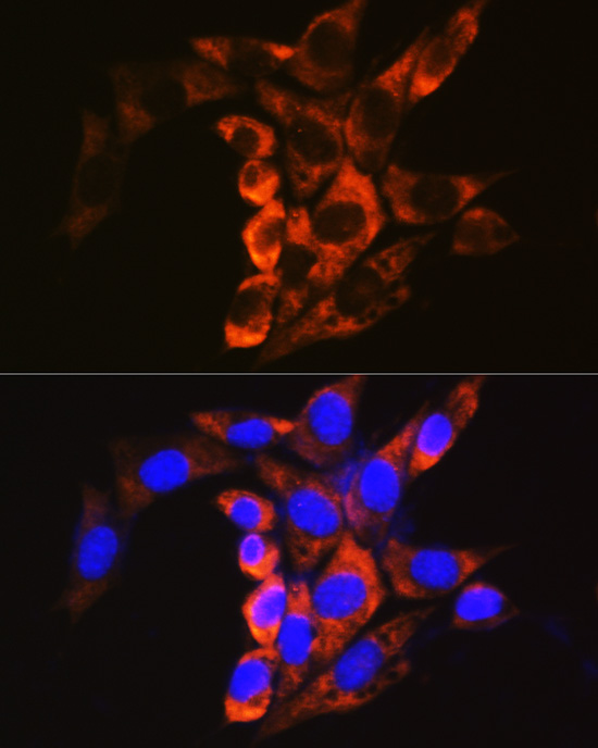 CAPN1 Antibody