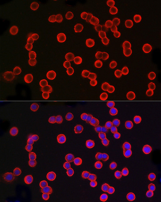 TACSTD1 Antibody