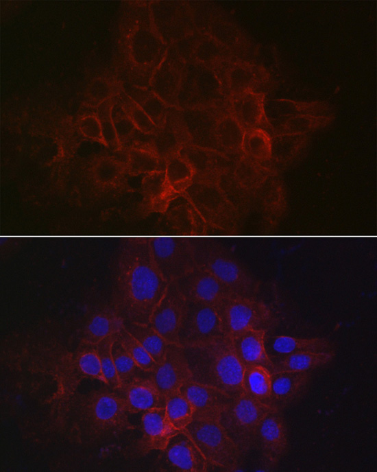 TACSTD1 Antibody