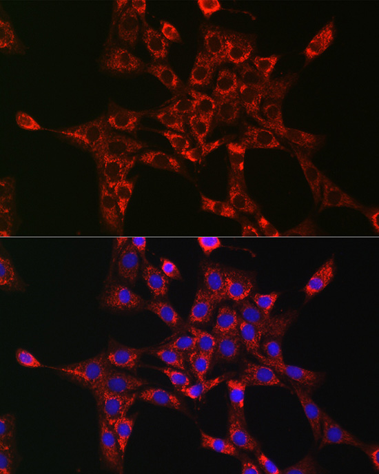 RAB5A Antibody