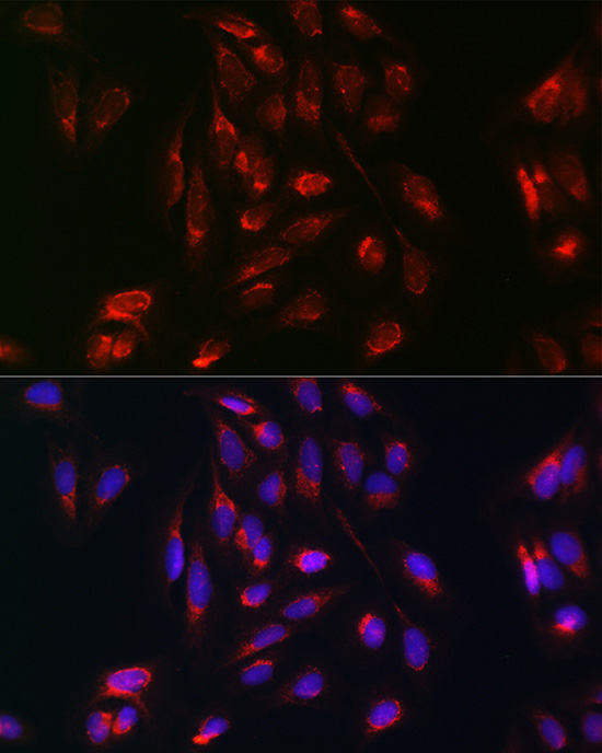 RAB5A Antibody