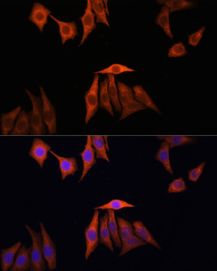 NRAS/HRAS/KRAS Antibody