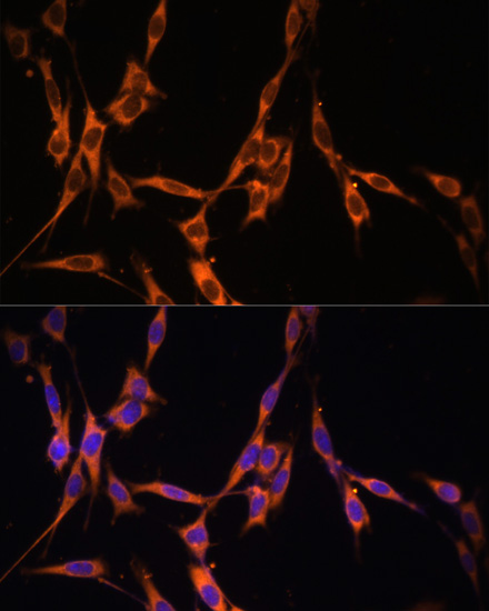 NRAS/HRAS/KRAS Antibody