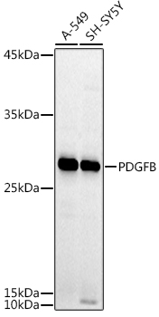 PDGFB Antibody