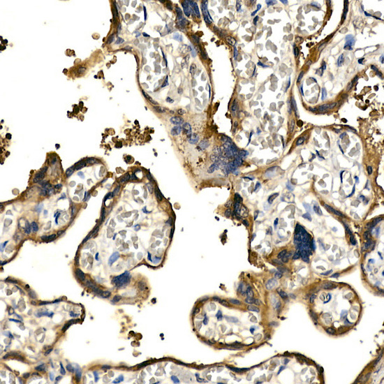 PDGFB Antibody