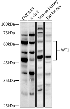 WT1 Antibody