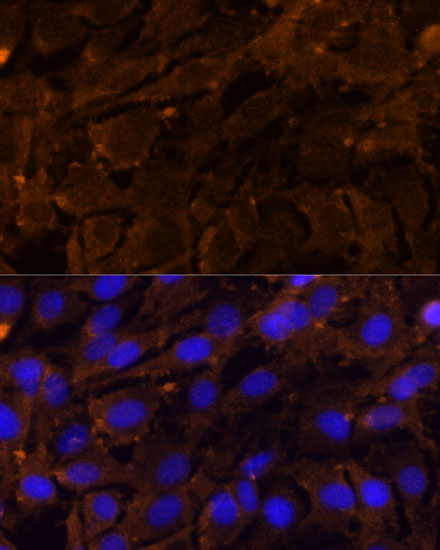 MMP3 Antibody