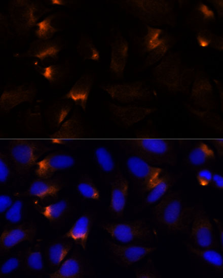 MMP3 Antibody