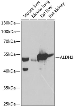 ALDH2 Antibody