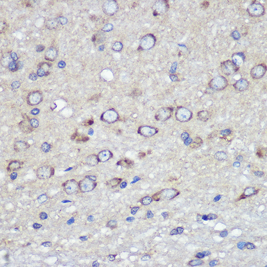 F11R Antibody