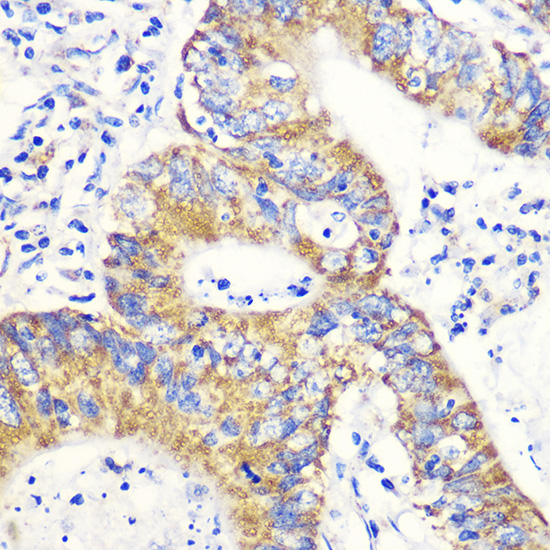 NFE2L2 Antibody