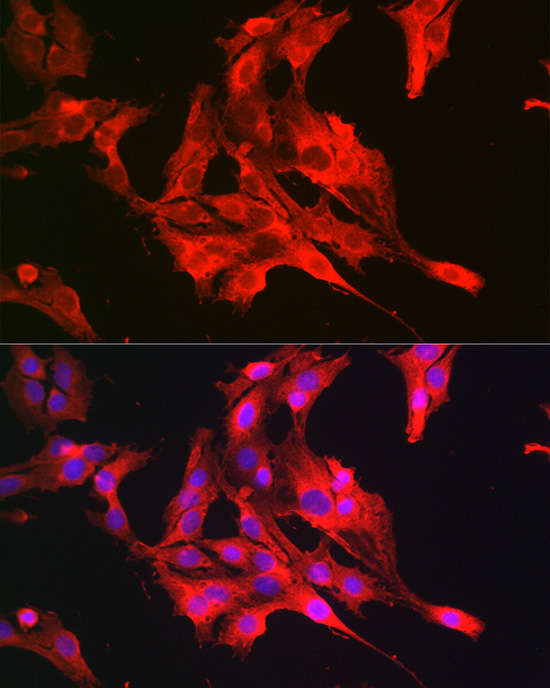 NFE2L2 Antibody